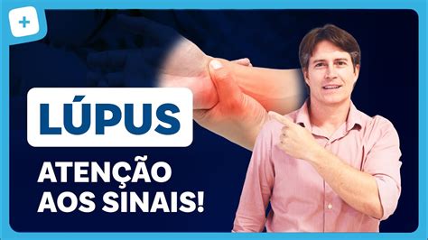 por o lupo|Lúpus: o que é, sintomas e como conviver com a doença